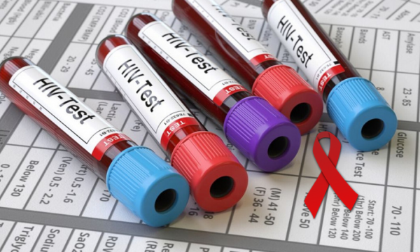 Trend shqetësues i rritjes së infektimeve me HIV në Kosovë, dhjetë raste brenda pesë muajve të parë të këtij viti